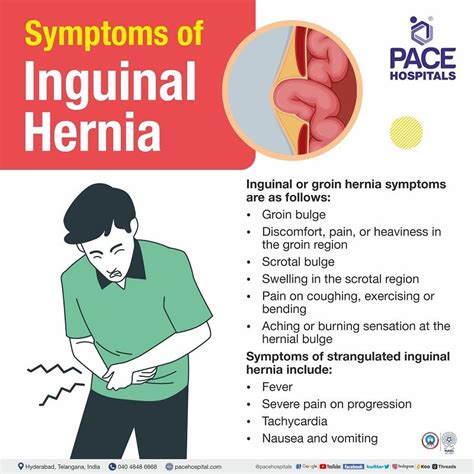 signs and symptoms of inguinal hernia